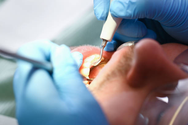 Best Weekend Emergency Dentist in Hybla Lley, VA